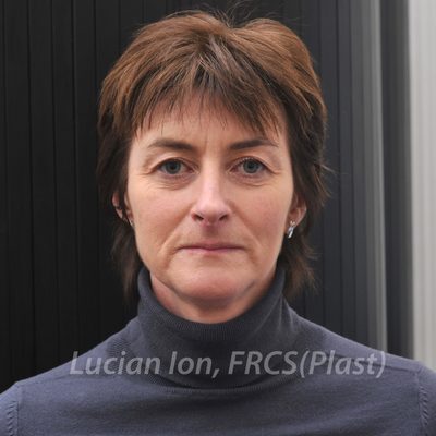 Before deep contouring neck lift, case 11, front view